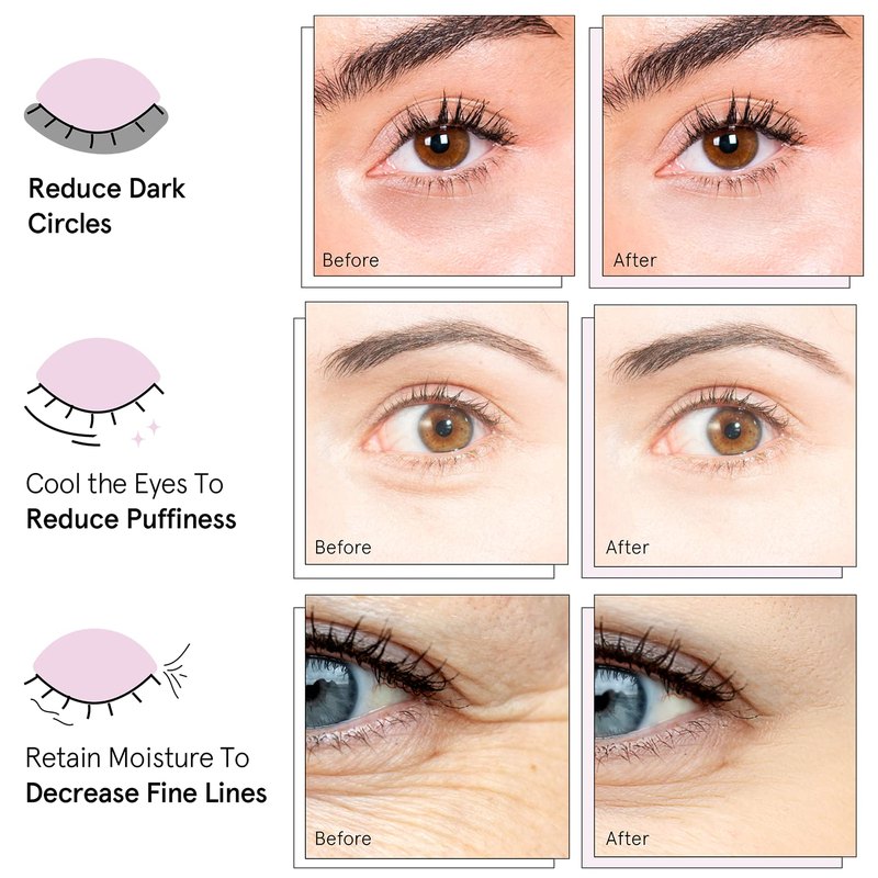 Gel Under Eye Patches - Reduce Dark Circles, Puffy Eyes, Undereye Bags, Wrinkles