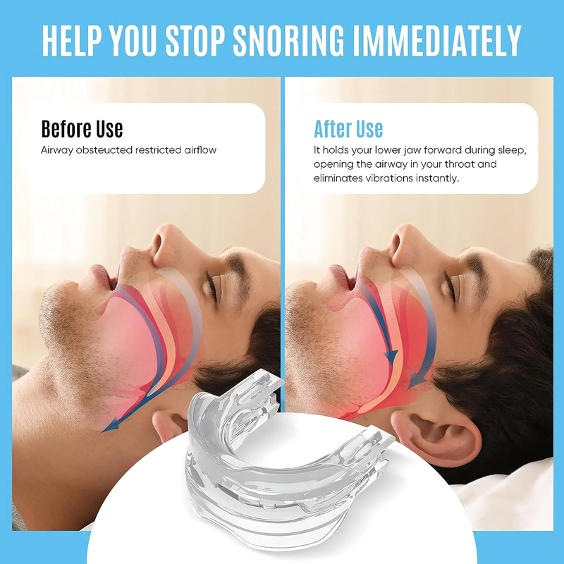 Professional Comfortable Anti-Snoring Device Mouthpiece