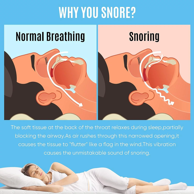 Professional Comfortable Anti-Snoring Device Mouthpiece