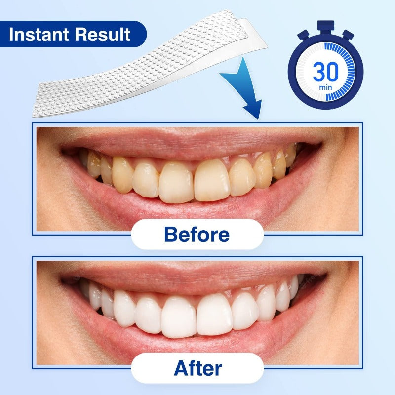 14 Sets Teeth Whitening Strips, Helps to Remove Smoking Coffee Soda Wine Stain